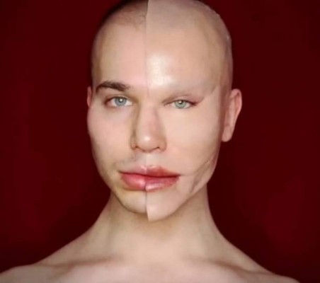 Makeup artist engaña a sus seguidores con espantosa cirugía