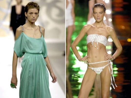 Modelos víctimas de anorexia y bulimia