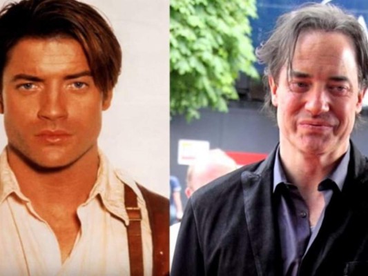 El antes y el después de famosos que no podrías reconocer a simple vista