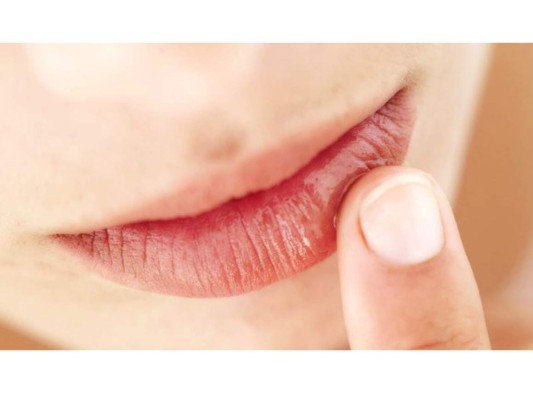 Los mejores trucos para los labios resecos