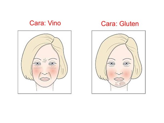 Los efectos del alcohol y el azúcar en tu rostro
