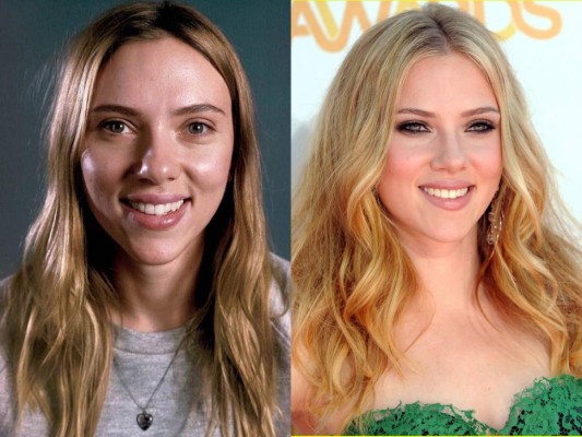El antes y después de estas hermosas celebridades  