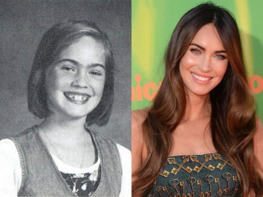 El antes y después de estas hermosas celebridades  