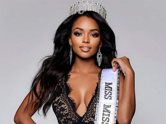Miss Universo 2020: Conoce a las mujeres más bellas