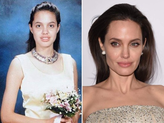 Angelina Jolie La actriz, modelo, filántropa, actriz de voz, directora y guionista estadounidense, es hija de artistas. Divorciados sus padres, de niña quiso actuar pero su autoestima se vio disminuida tras un intento de convertirse en modelo mientras estaba en la secundaria pero sus compañeros se burlaban de su aspecto por lo que empezó a maltratarse a sí misma. Algunas de sus mascotas murieron a causa de sus experimentos y comentó que a la edad de doce años «era una niña mala y golpeaba a mis amigos». Siempre tuvo mala relación con su padre y presentó una solicitud para cambiar legalmente su nombre por el de 'Angelina Jolie', incluso ha llegado a afirmar que la única razón del distanciamiento con su padre es que no quiere que sus hijos crezcan cerca de él y los llame 'nietos'.