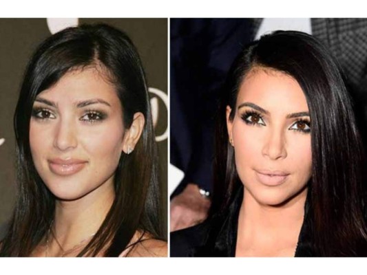 El antes y el después de famosos que no podrías reconocer a simple vista