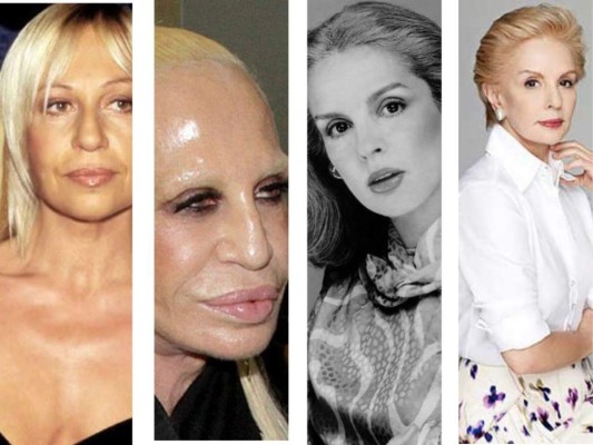 Este es el antes y después de varios famosos que para algunos, el abuso de cirugías, drogas y alcohol ha tenido consecuencias irreversibles en el aspecto físico de muchos de estas celebridades.