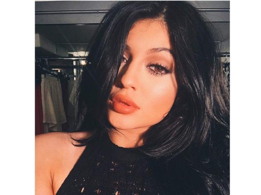 Kylie Jenner se quita el relleno de los labios