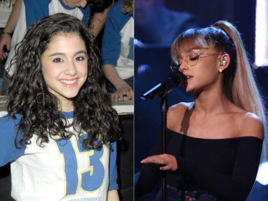 Before and After de las Celebrities