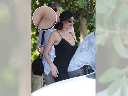 Angelina Jolie muestra cicatriz de su mastectomía
