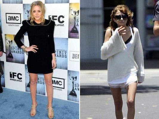 10 famosas que padecen anorexia