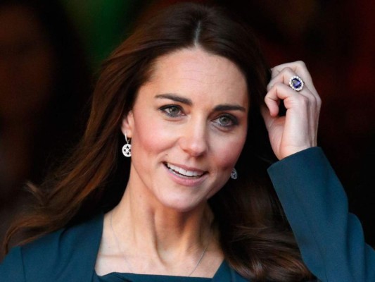 ¿La Duquesa de Cambridge Kate Middleton se puso bótox? 