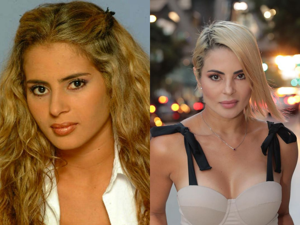 Antes y después de los actores de “Yo soy Betty, la fea”