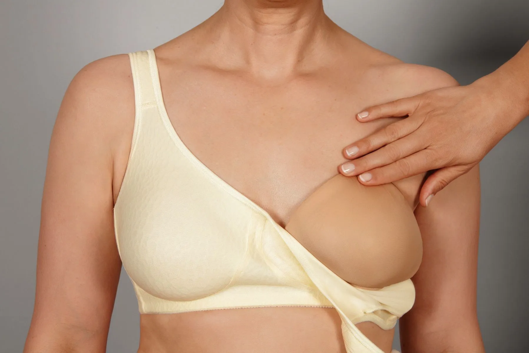 La cirugía reconstructiva después de una mastectomía: Opciones y consideraciones