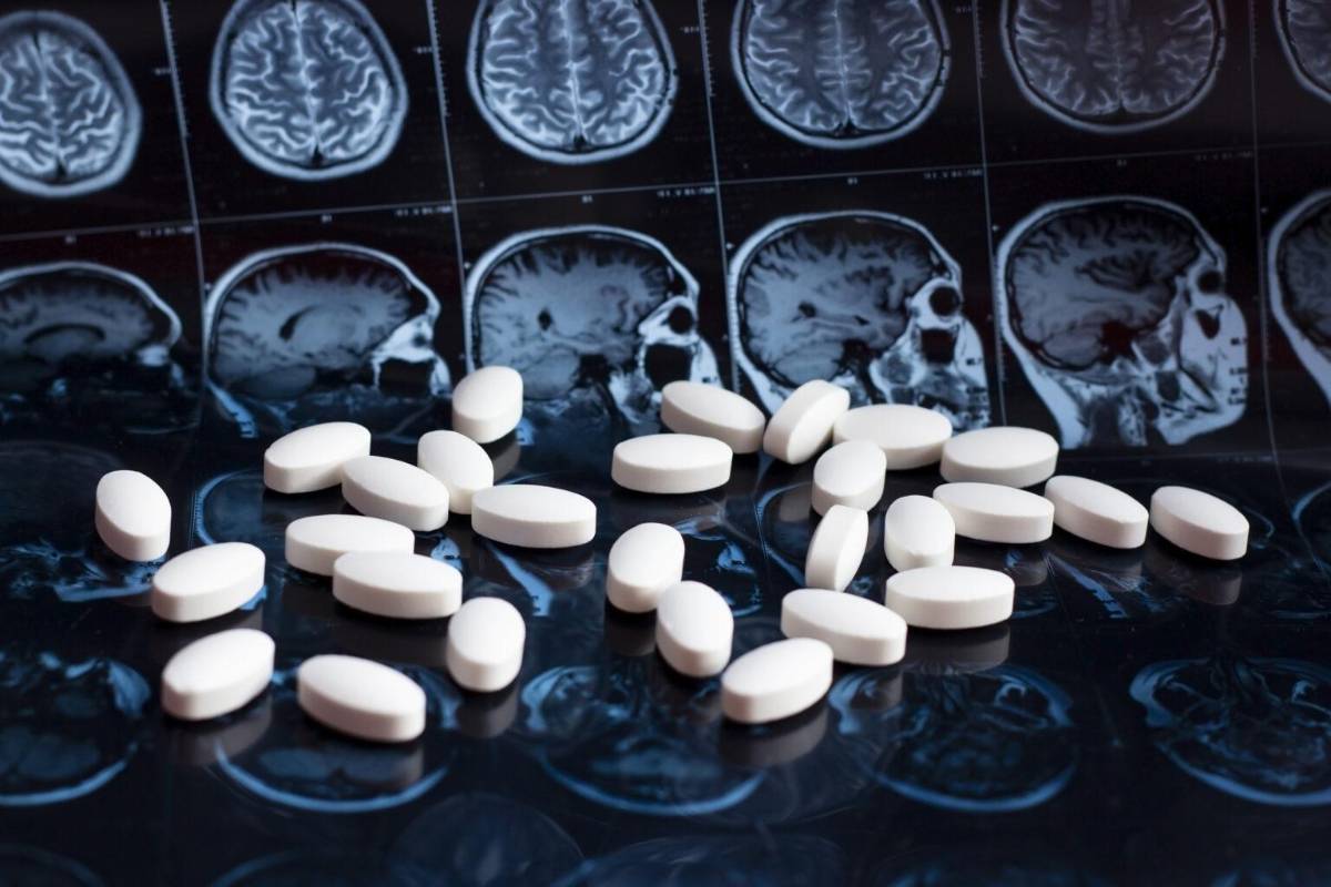 Alzheimer: cinco avances que están cambiando lo que sabemos sobre la enfermedad