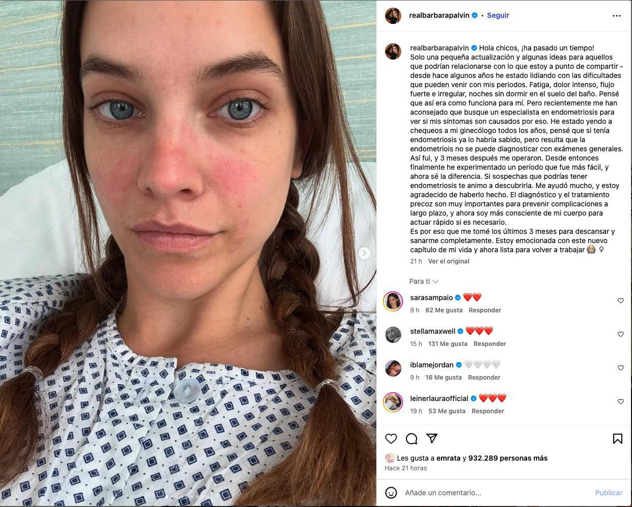 El anuncio del bebé Sprouse es conmovedor, pues la modelo de Victoria’s Secret había compartido sobre su lucha contra la endometriosis hace menos de un año vía Instagram, tratándose de una enfermedad benigna que afecta la vida reproductiva de las mujeres, por la cual tuvo que someterse a cirugía.