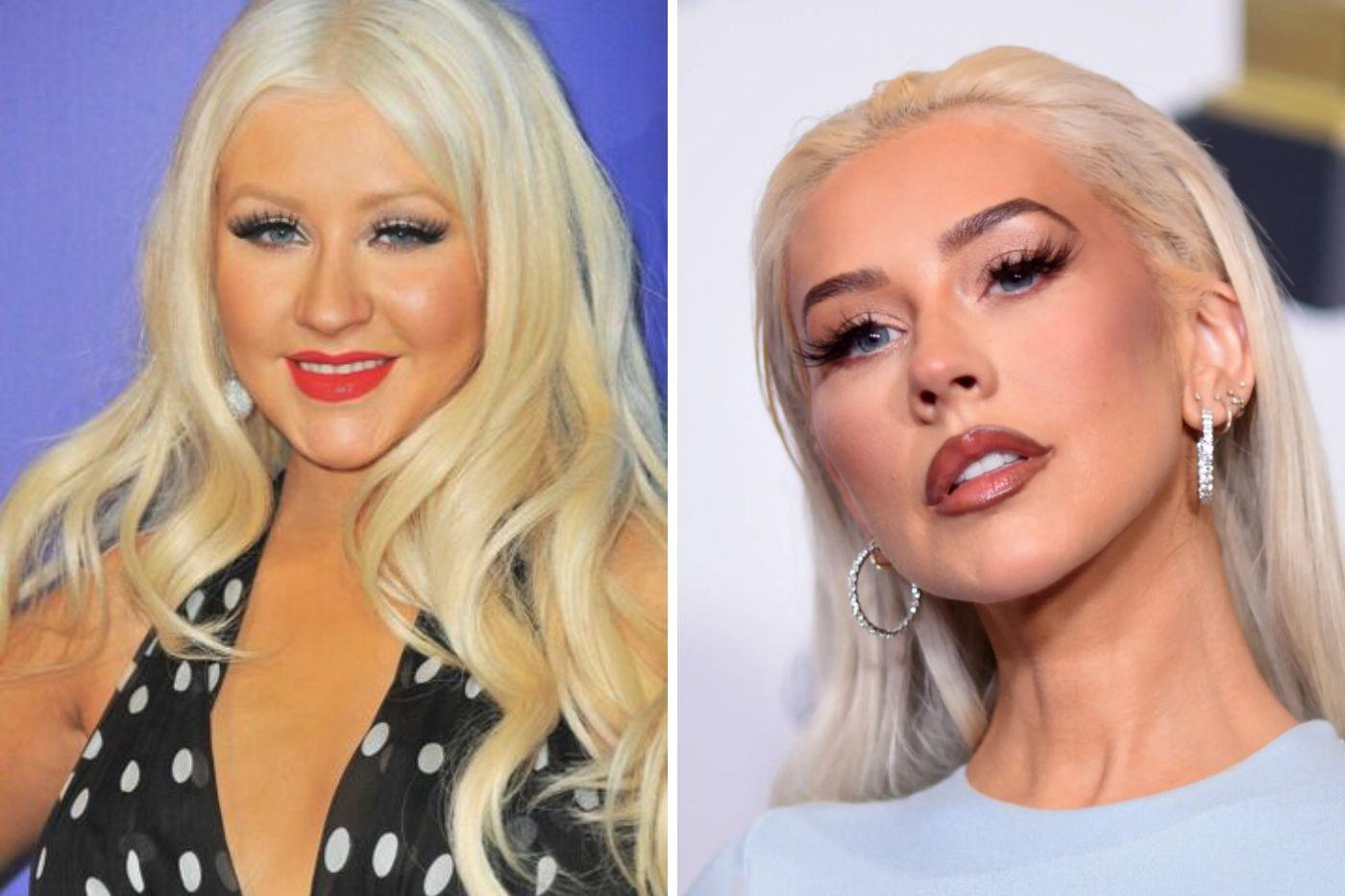 Christina Aguilera, ha incorporado el uso de xeomin, un tratamiento inyectable que viene siendo similar al botox, para suavizar las lineas de expresión en su rostro, sin embargo ha mantenido su piel radiante gracias a su rutina de belleza donde utiliza productos como Cetaphill, para limpiar he hidratar su piel. Aunque se han esparcido rumores de cirugía plástica, solamente ella sabe como ha logrado mantenerse tan joven. 