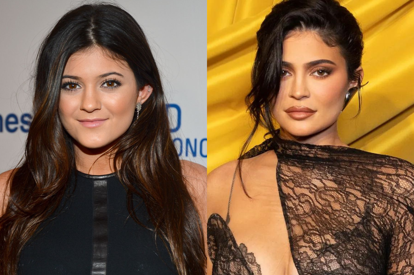 Kylie Jenner durante varios años negó haberse realizado cualquier tipo de retoque estético. Pero fue hace poco que la modelo aclaró públicamente que, a pesar de recordar amarse tal cual era de niña, llegó a editar sus fotos, es así como también confesó haberse operado el busto y someterse a rellenos de bótox. 