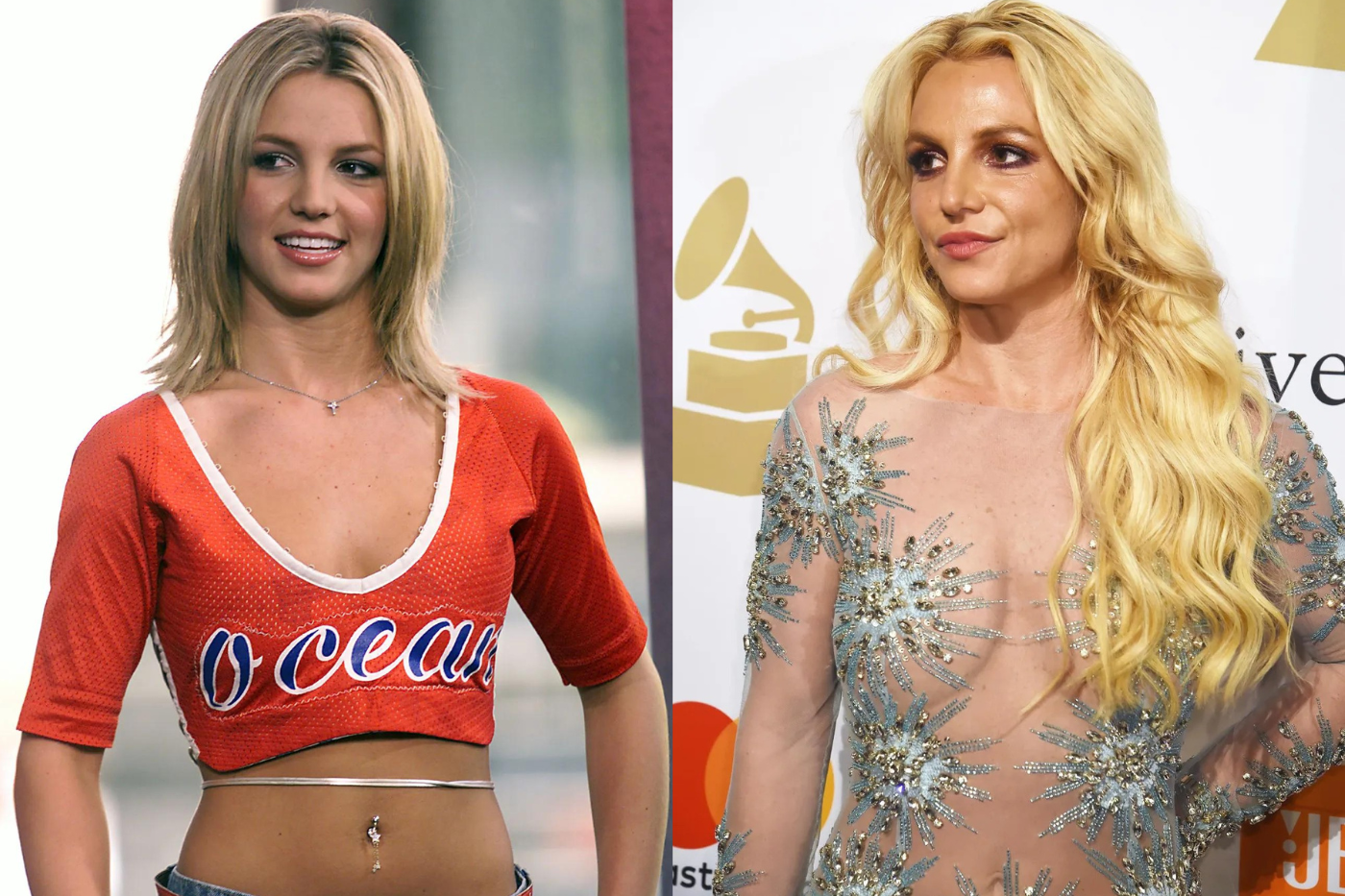 Britney Spears se ha esforzado por mostrarse real y, a pesar de haberse sometido al bótox como remedio para minimizar los signos de edad, el procedimiento la llevó a lucir párpados morados y azules. También se menciona de un pequeño retoque de labios. 
