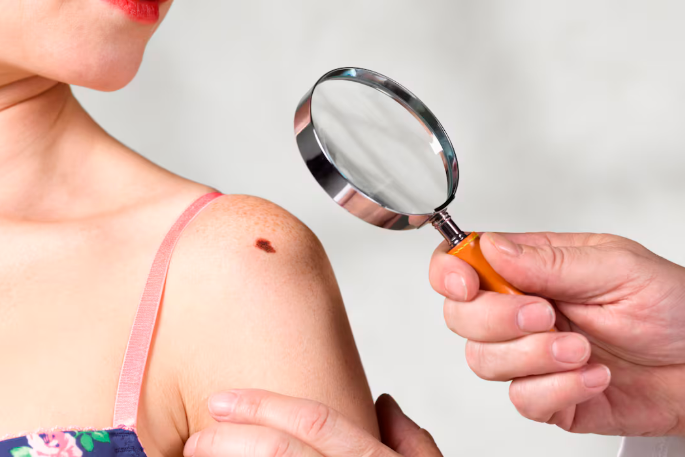 Las revisiones dermatológicas regulares pueden detectar problemas potenciales a tiempo y reducir el riesgo de complicaciones graves.