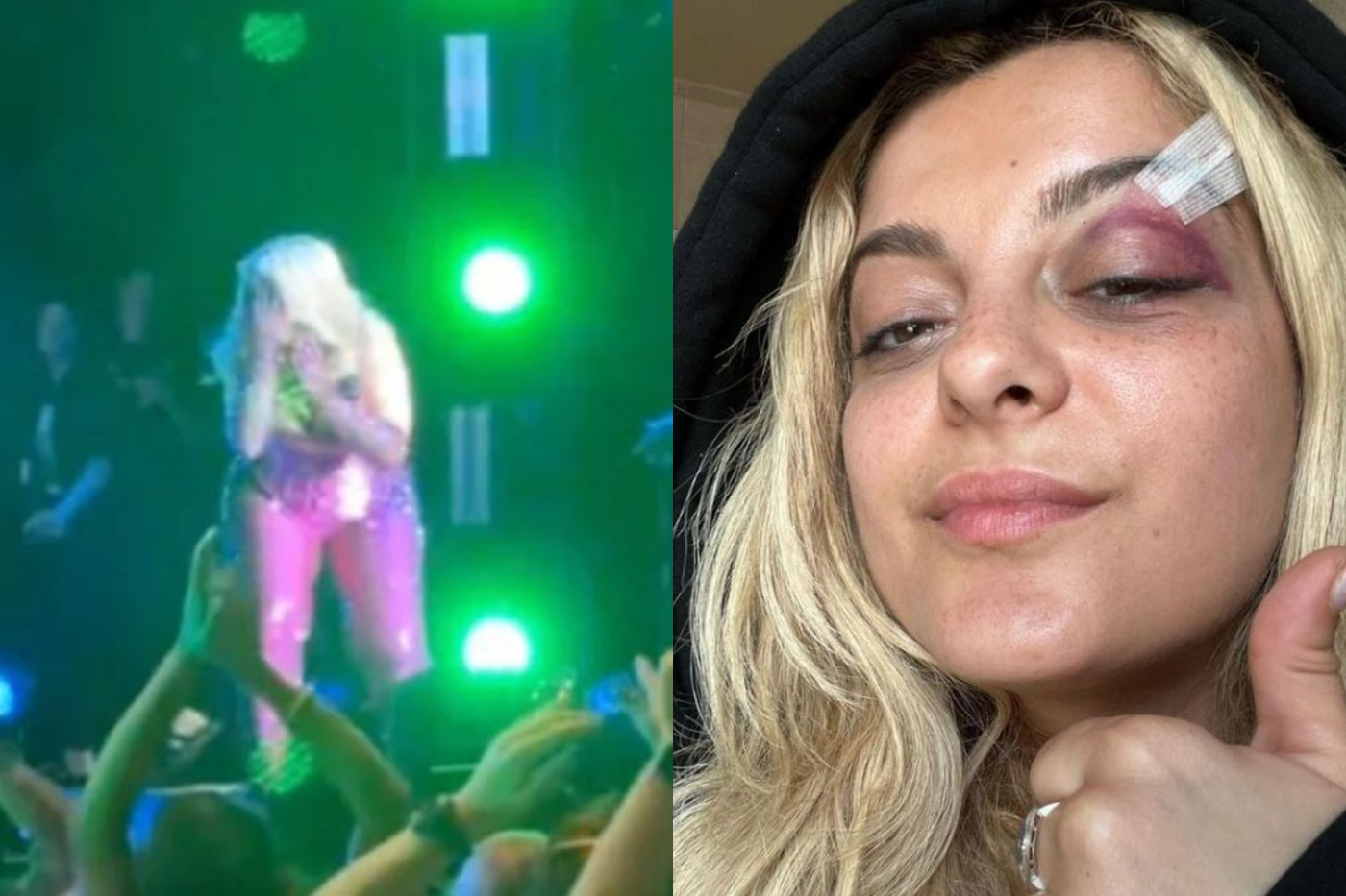 Durante un concierto en Nueva York, un fan lanzó un teléfono a Bebe Rexha, cayéndole en el rostro. La cantante tuvo que ser llevada al hospital de emergencia y quedó con una herida abierta y un ojo negro. El admirador fue arrestado. 
