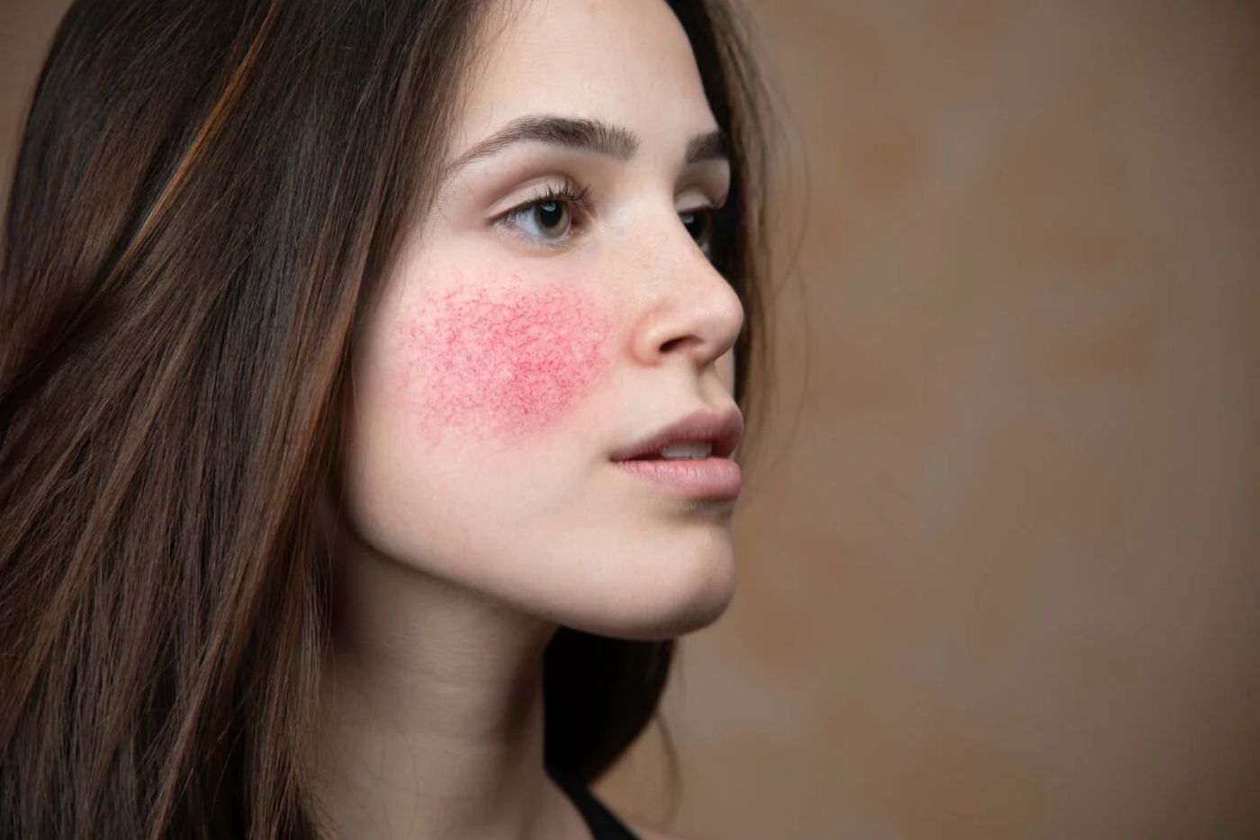 Enrojecimiento facial.