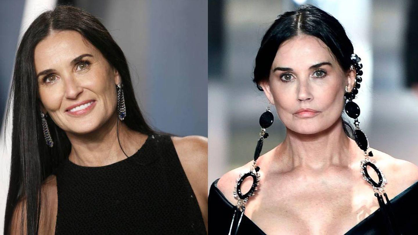 Demi Moore, también se ha sometido a algunos procedimientos estéticos para mejorar su apariencia, tales como: Rellenos de ácido hialurónico, botox, lifting facial y tratamientos con láser, añadiendo también un cuidado a su piel, con hábitos saludables. 