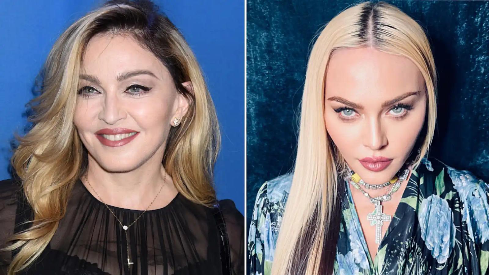 La cantante Madonna, ha sido una de las celeridades que más procedimientos estéticos se ha realizando para conservarse joven. Sometiéndose a cirugías faciales, como lifting, además de botox, ha hecho uso de tratamiento láser y radiofrecuencia para tensar su piel. De igual forma utiliza maquillaje y mantiene una gran disciplina en su estilo de vida. 