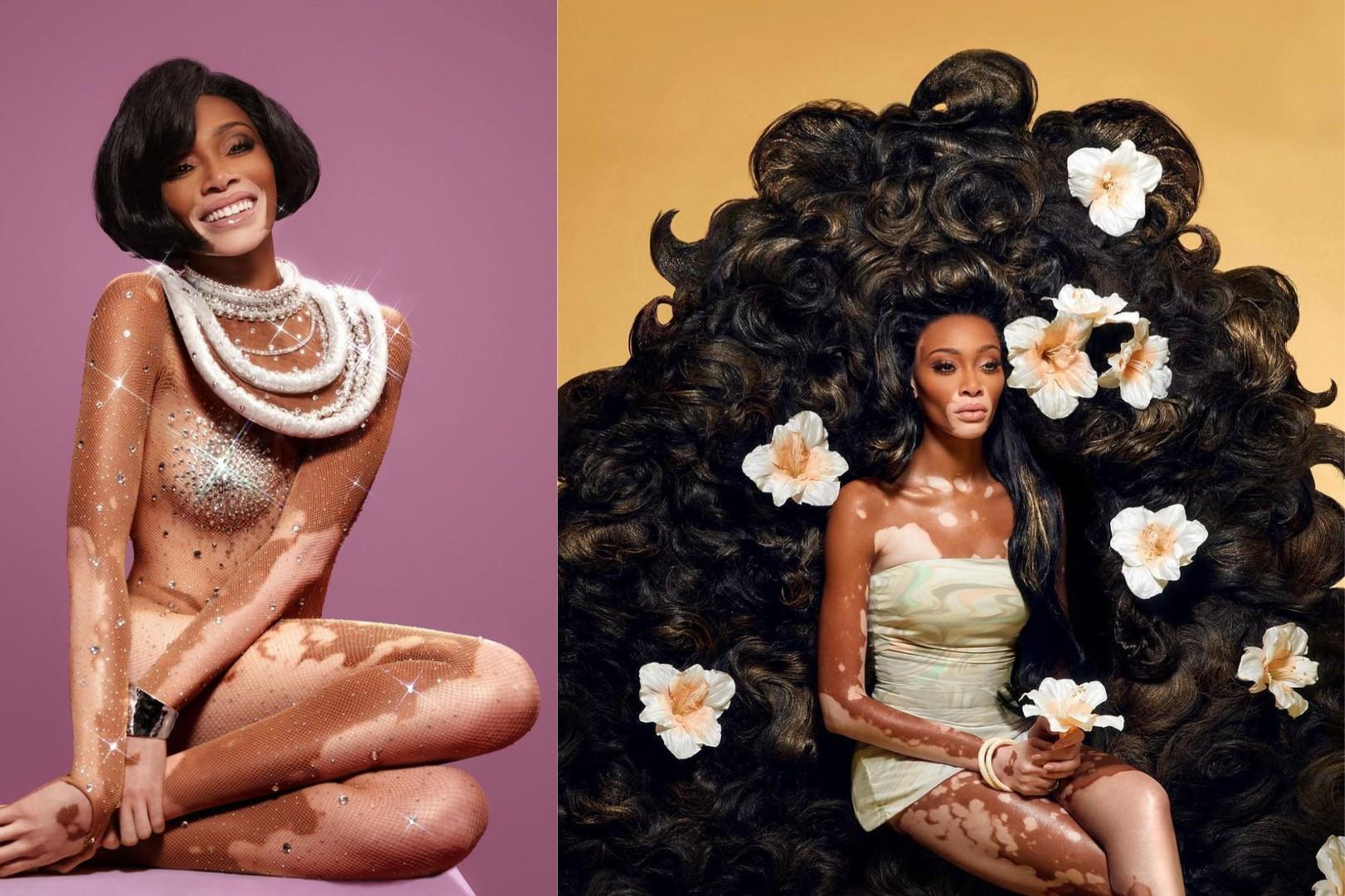 Winnie Harlow: Hizo un homenaje a Diana Ross, vistiendo una copia de sus looks más icónicos. 