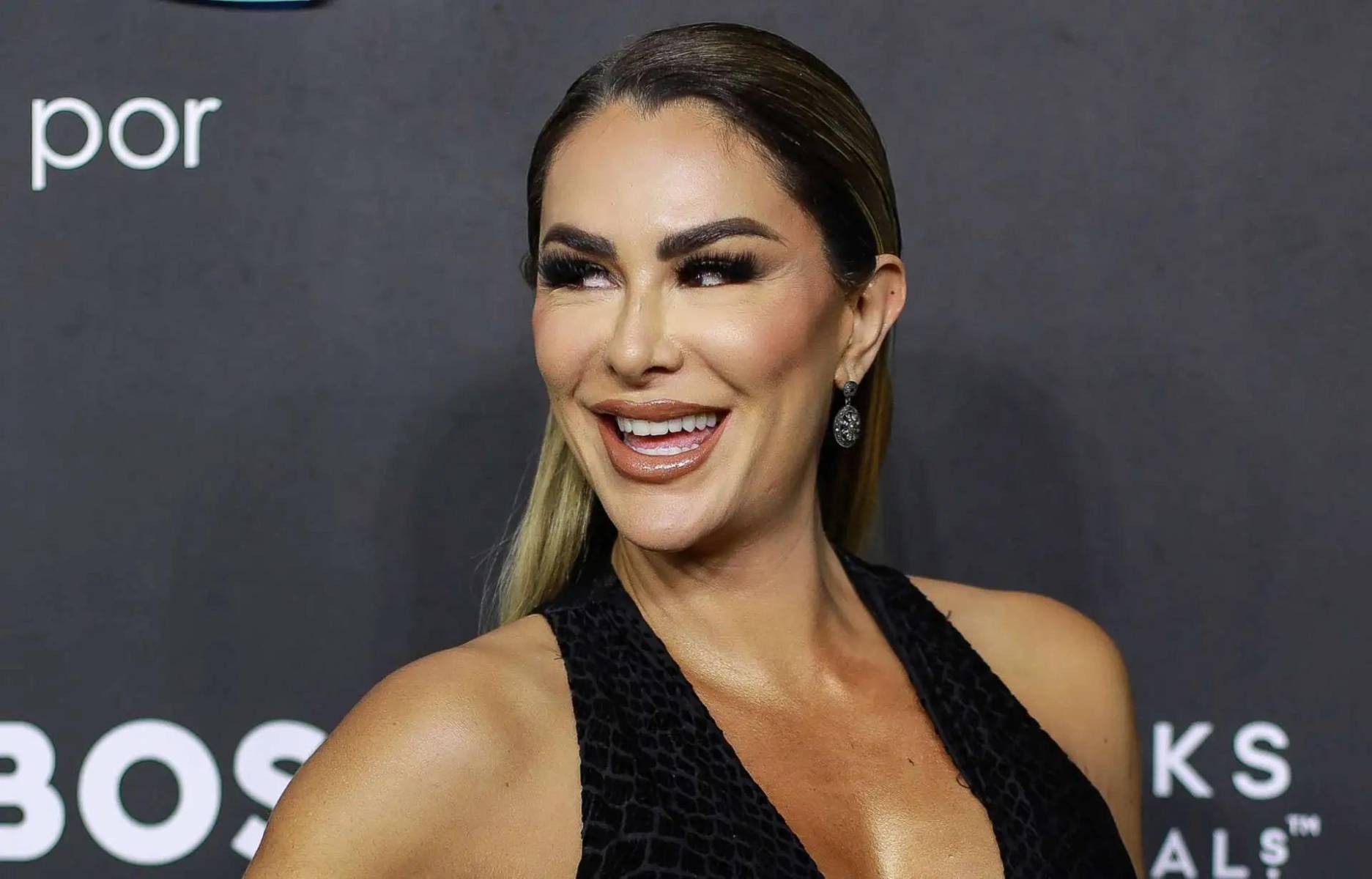 Ninel Conde. La actriz sufrió un accidente aterrador cuando chispas de una lámpara en una discoteca le cayeron en el pelo, causando un pequeño incendio.