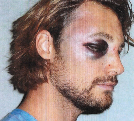 Gabriel Aubry cuenta su versión sobre la pelea con Olivier Martínez