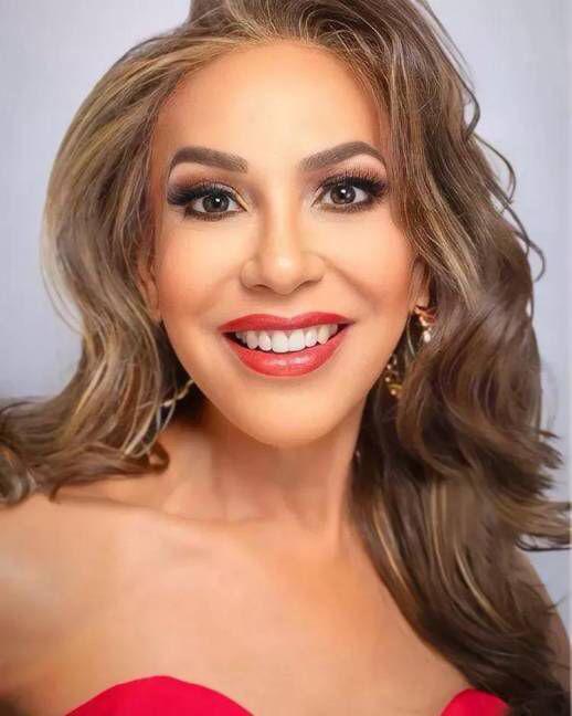 Jackie Garcia-Martínez, CEO de Bazaar Models, la agencia que representó a Teijo, expresó su orgullo por apoyar a mujeres diversas. “Represento a mujeres de todas las formas, edades y razas. Mientras preparo a mi equipo para competir en Miss Texas, estoy encantada de apoyar a estas mujeres que me inspiran como líder todos los días”, afirmó en una entrevista con USA Today.