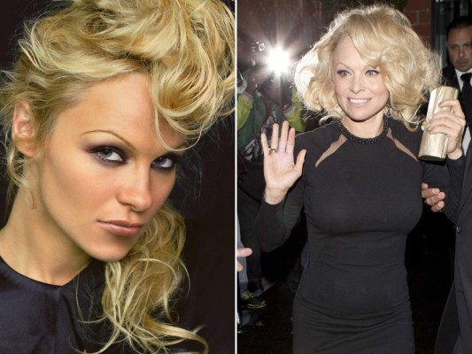 Pamela Anderson. Su afición por la cirugía estética le ha llevado a pasar por la mesa de operaciones en varias ocasiones. Su imagen es muy artificial.