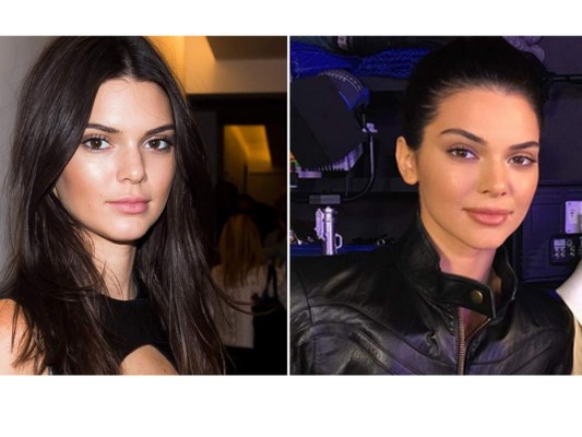 Kendall Jenner luce labios más voluptuosos  
