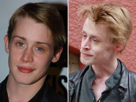 La estrella de los 90's, Macaulay Culkin, vivió el divorcio de sus padres, el fracaso de su matrimonio a los 18 años y el abuso del alcohol y las drogas. Hoy no queda ni la seña de 'Mi pobre angelito'. Está consumido por el uso de las drogas.