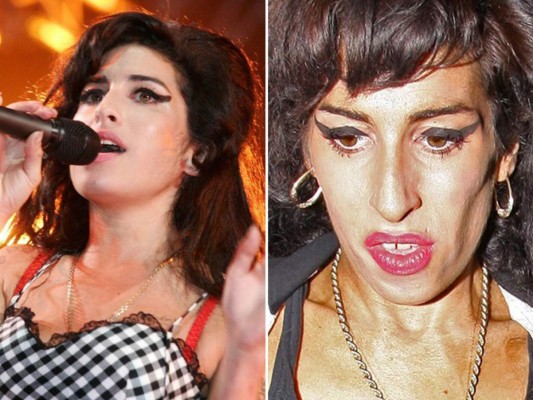 17 famosos desfigurados por las drogas