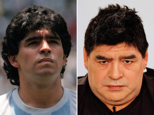 No solo los actores se esmeran por cuidar su apariencia física. A la lista se suman algunas leyendas del fútbol, como Diego Armando Maradona. El exfutbolista quien luce nueva cara al pasar por el quirófano ahora tiene una nariz respingada, la piel más tersa y blanca, las bolsas debajo de sus ojos han desaparecido y sus labios son ahora más carnosos y tienen un color más rosado.