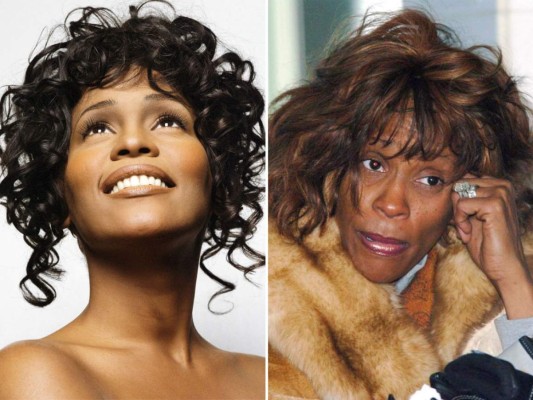 17 famosos desfigurados por las drogas