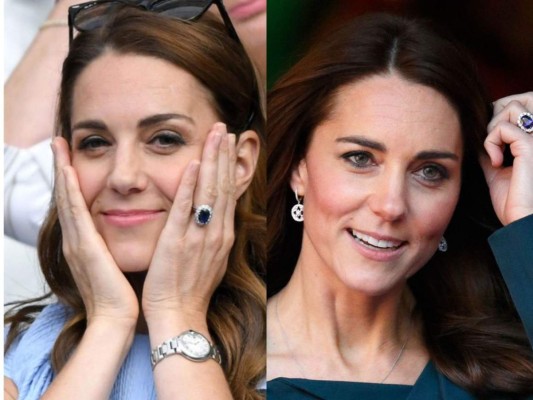 ¿La Duquesa de Cambridge Kate Middleton se puso bótox? 
