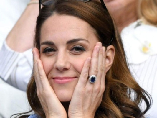 ¿La Duquesa de Cambridge Kate Middleton se puso bótox? 