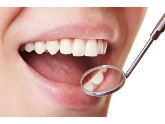 Previene la formación de placa dental.