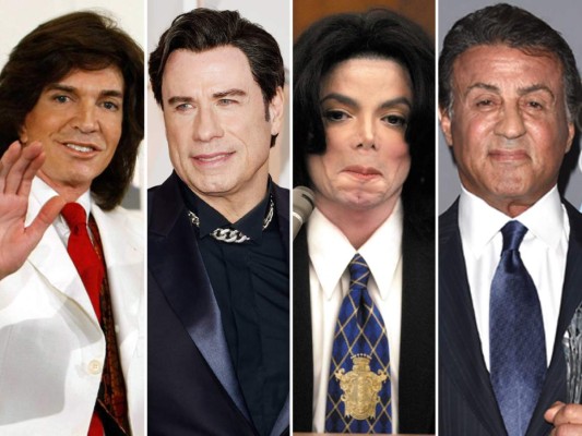 Camilo Sesto, John Travolta, Michael Jackson y Sylvester Stallone son algunas de las celebridades que abusaron del botox y de las cirugías hasta quedar irreconocibles.