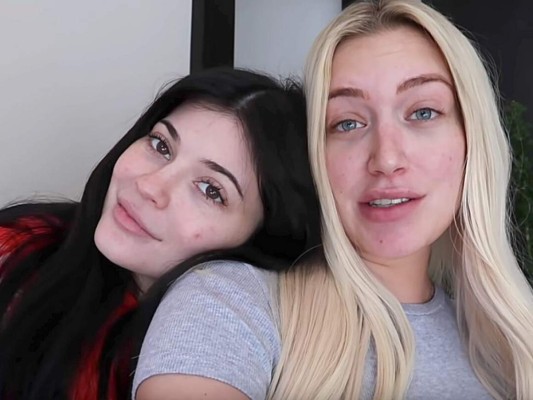 Kylie Jenner se realiza cirugía de ojos junto a nueva mejor amiga