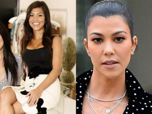 Kourtney a diferencia de sus hermanas no tiene problema en hablar sobre sus implantes de senos y como mejoraron su seguridad.