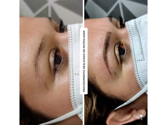 Microlaser Esthetic Clinic: encargados de tu bienestar y belleza