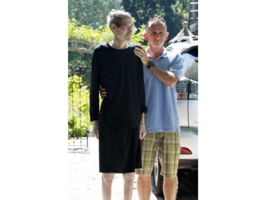 Steve Jobs<br/>El hombre famoso por sus dispositivos electrónicos con el logo de la manzanita perdió la vida por un cáncer de páncreas, esta foto es de los últimos días antes de su muerte.<br/>