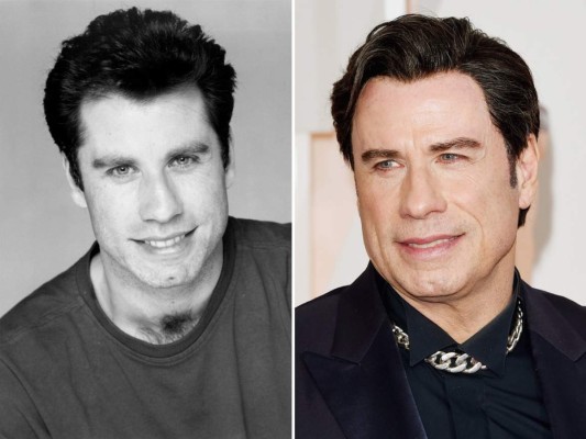 Del atractivo chico de Grease y Fiebre del sábado por la noche no queda ni las señas. Los excesos con el bisturí y su desfigurada cara han llevado a John Travolta a ser el centro de burlas.