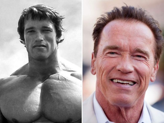 Ni la seña queda de lo que fue Arnold Schwarzenegger en sus años dorados. El actor y ex gobernador de California se ha inyectado botox y se ha sometido a injerto de cabellos.