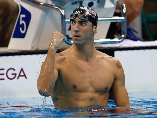 Michael Phelps. El nadador tiene el Síndrome de Marfan. Una extraña enfermedad que afecta al tejido conectivo y diferentes estructuras como pulmones, ojos o corazón.