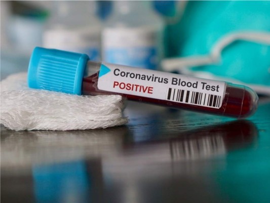 Resultados positivos de medicamentos para COVID-19 y más..